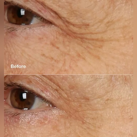 Clinique Smart Clinical Repair Overnight Recovery Cream + Mask - Picture 4 of 7